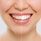 Zahnaufhellungsstreifen Wripes